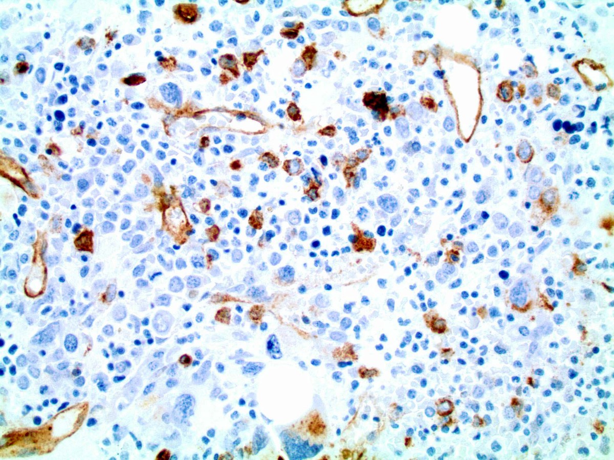 CD34 200X